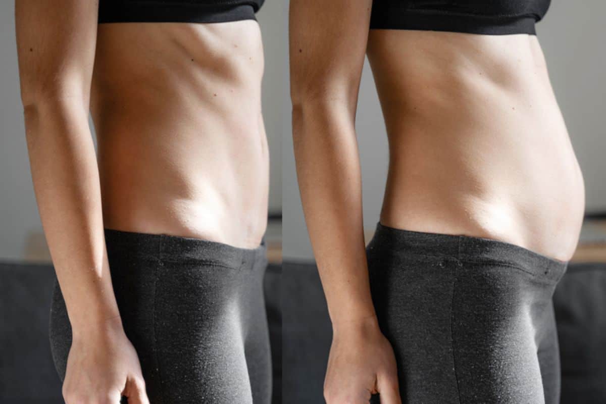 How long does diastasis recti take to improve St Helens?