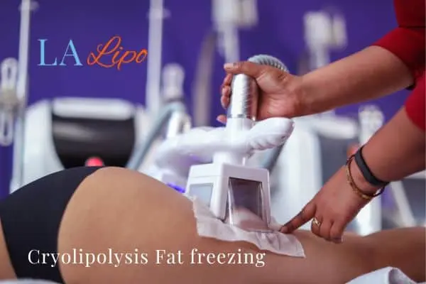 women getting fat freezing St Helens