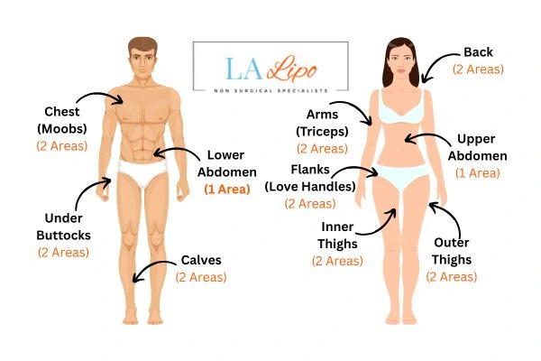 LA LIPO Cryolipolysis Areas St Helens
