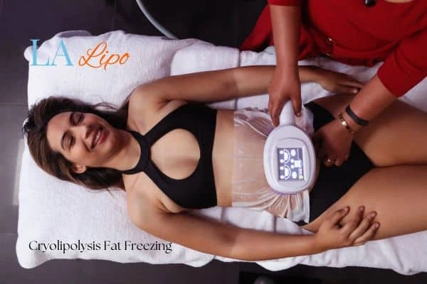 woman getting cryolipolysis St Helens