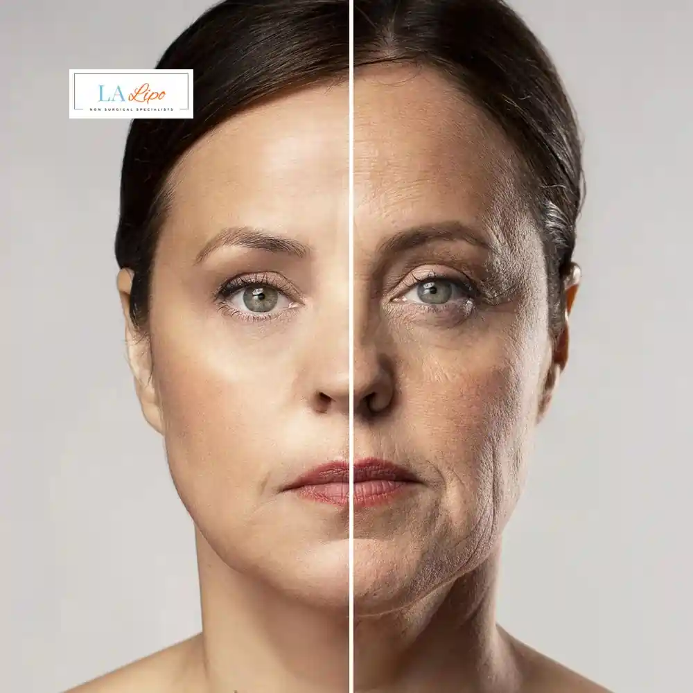 How Can You Tell If Non-Surgical Skin Tightening Is Right for You St Helens?