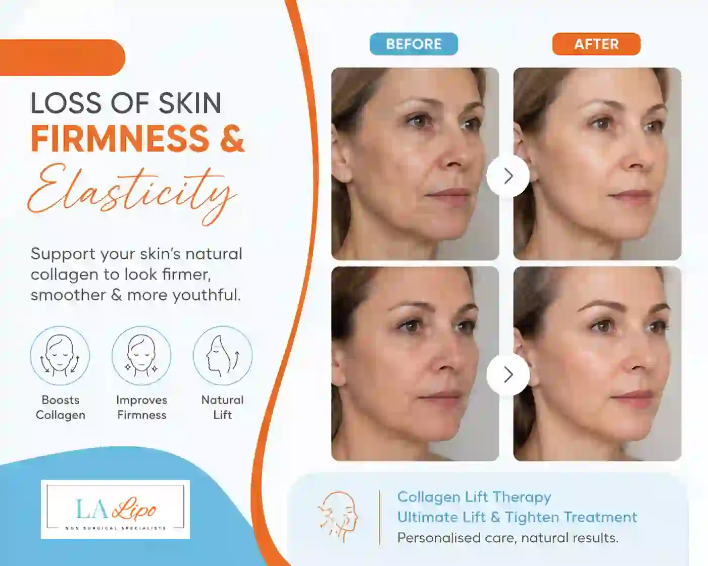 Sign #7: Loss of Skin Firmness and Elasticity St Helens