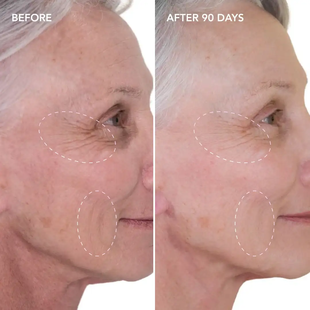When will you see results St Helens